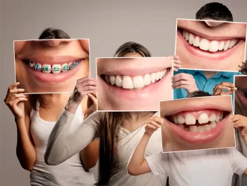 youth mouth guard