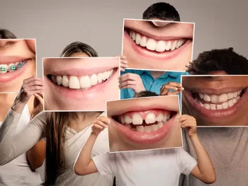 youth mouth guard