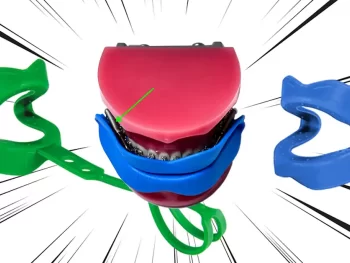 forsus herbsts mouthguard