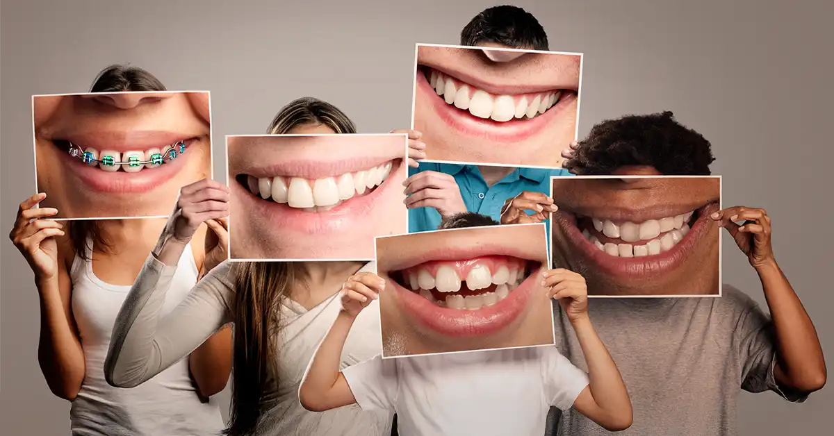 youth mouth guard