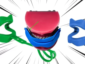 forsus herbsts mouthguard