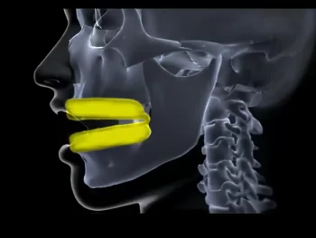 natural fit mouthguard