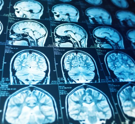 Concussion Management Guidelines concussion management